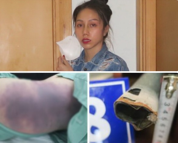 vu me ke bao hanh be 8 tuoi den tu vong da co ket luan giam dinh nguyen nhan hinh 2