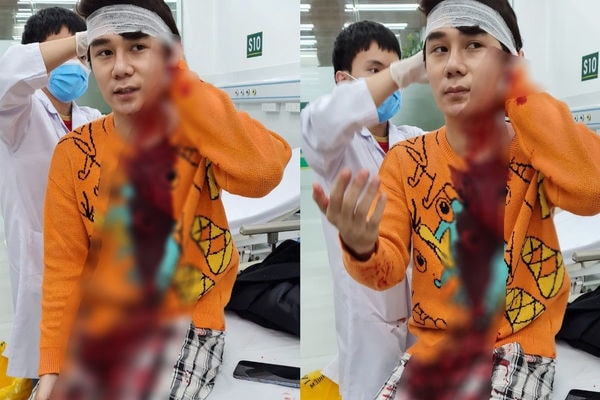 bat nghi pham chem trong thuong nam dien vien phim thuong ngay nang ve hinh 1