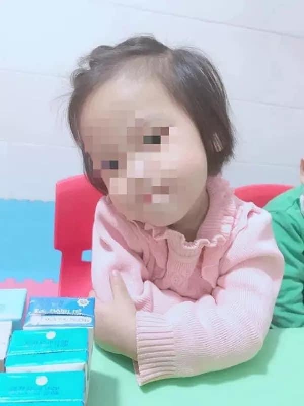 be gai 3 tuoi bi dong dinh vao dau da tu vong hinh 1