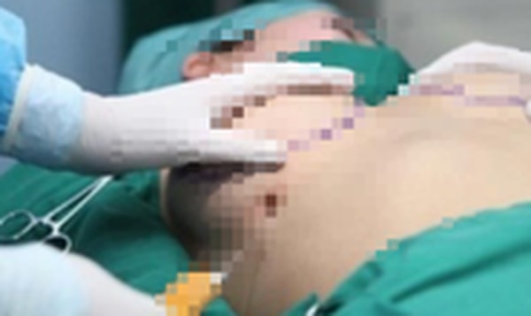 nguoi phu nu 61 tuoi tu vong sau khi nang nguc tai benh vien tham my kangnam sai gon hinh 1