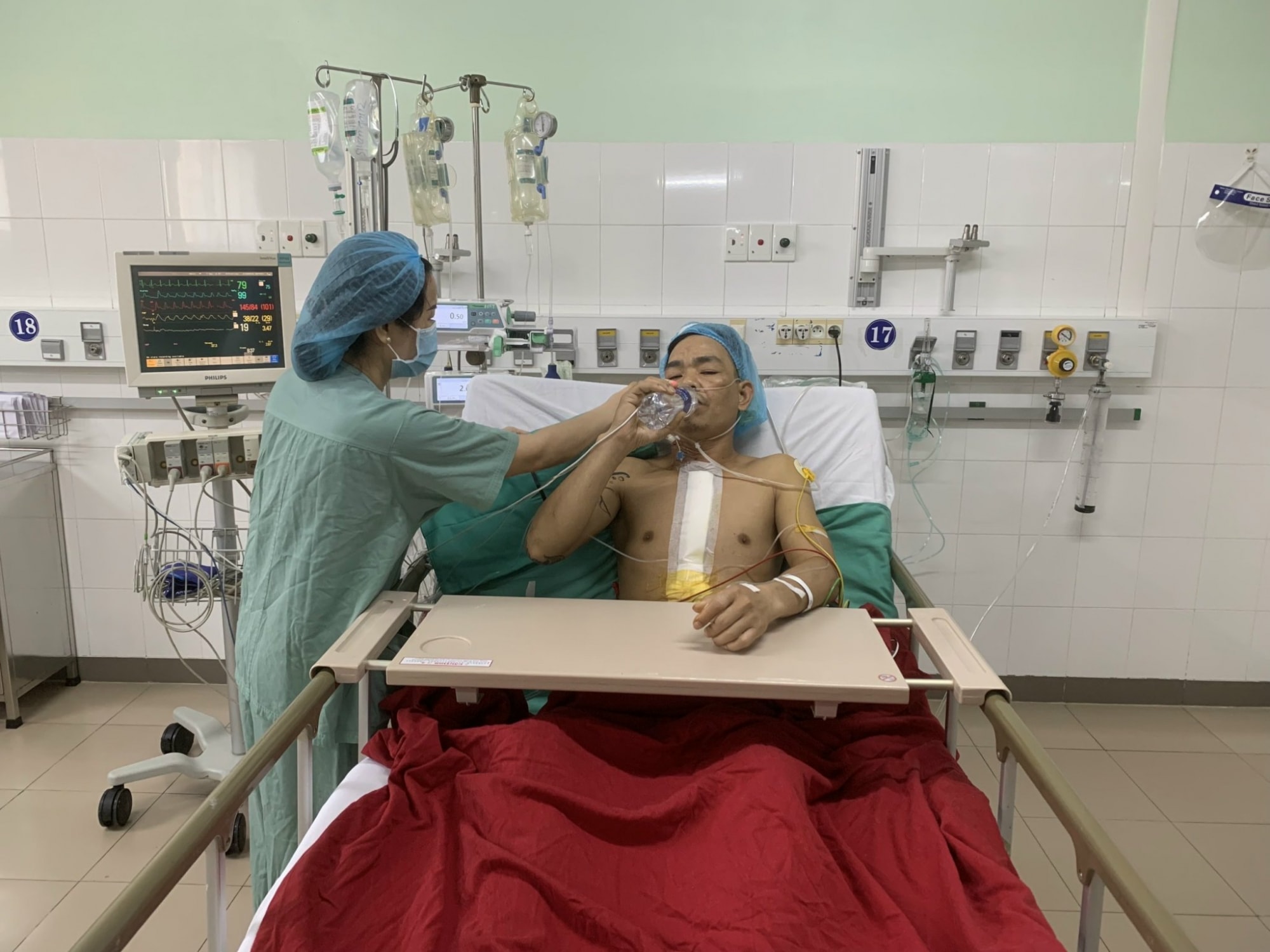 benh vien trung uong hue thuc hien thanh cong ca ghep tim xuyen viet dac biet hinh 3