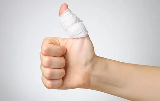 cach cam mau nhanh nhat khi bi dut tay hinh 2