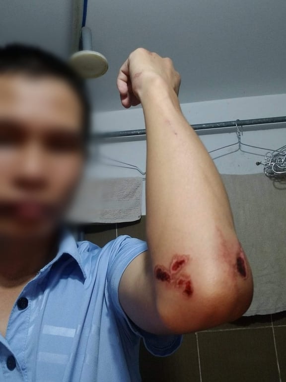 tai xe xe om cong nghe bi hanh hung da man truoc cong ben xe mien tay hinh 2