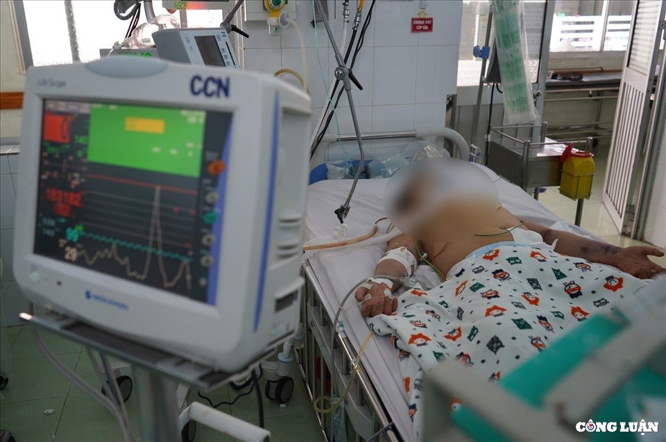 ben trong khu dieu tri sot xuat huyet nang o benh vien nhi dong 2 hinh 8