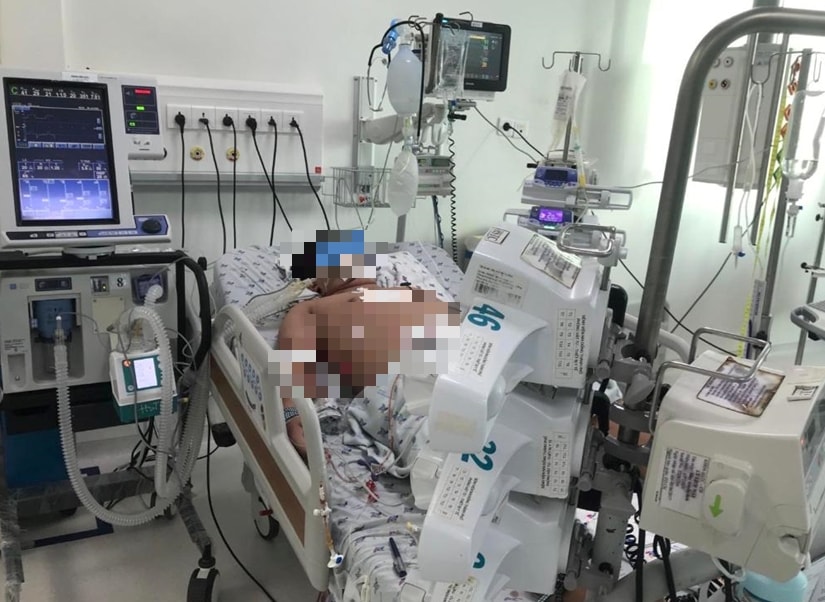 sot xuat huyet bac si luu y khong chu quan khi tre co cac dau hieu sau hinh 1