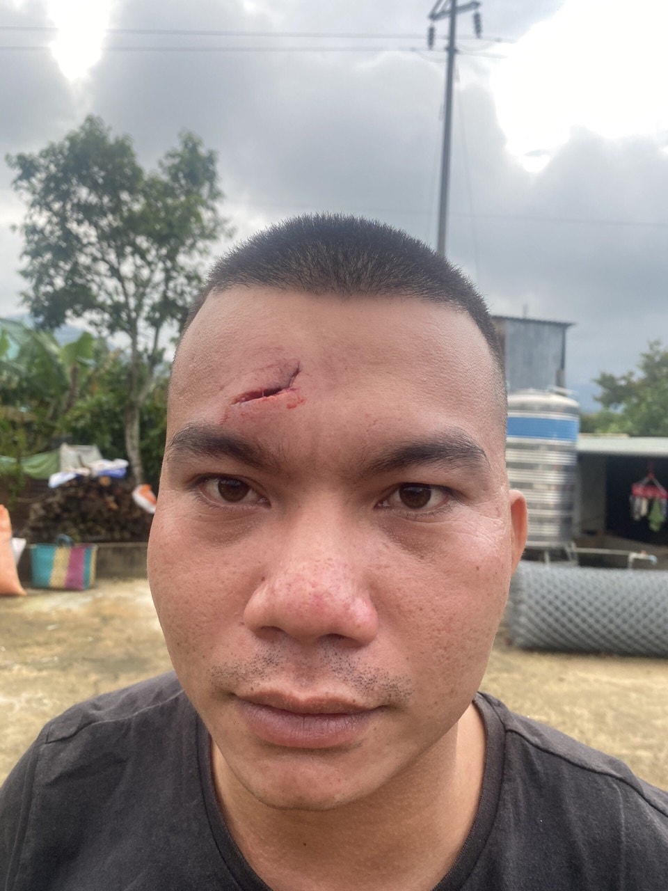 vu an co y gay thuong tich tai binh thuan bi hai gui don khang cao hinh 2