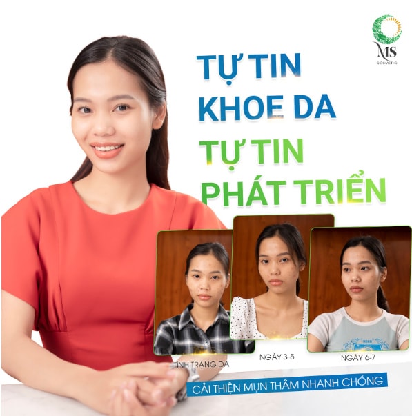 thanh lan mun ms cosmetic  than duoc cho lan da mun viem tham tu thien nhien hinh 3