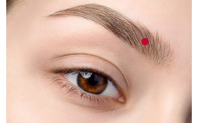 Nốt Ruồi Đầu Lông Mày