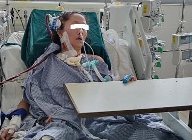 lam dung corticoid tu dieu tri cum benh nhan viem phoi boi nhiem rat nang hinh 1