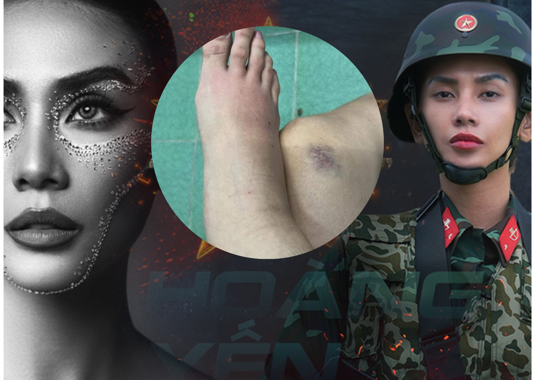 sieu mau hoang yen khien khan gia lo lang khi lo bi thoai hoa khop hinh 1