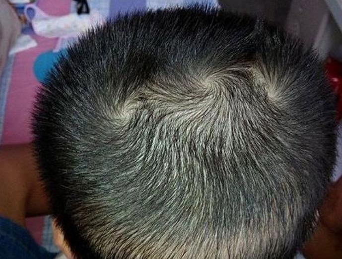 xem tuong xoay toc tren dau doan van menh tinh cach hinh 2