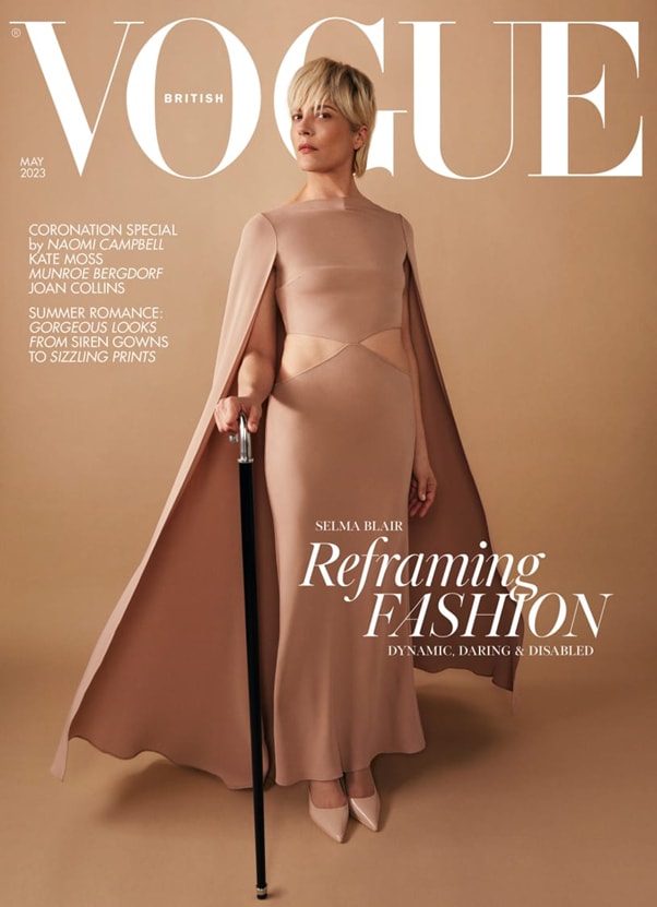 nguoi mau khuyet tat len trang bia tap chi thoi trang vogue hinh 3