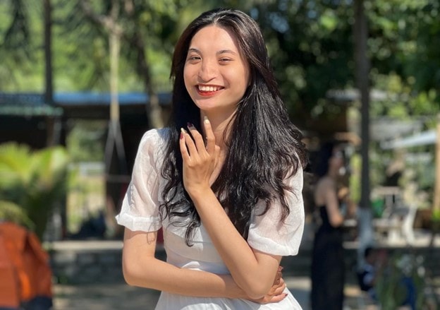 vuot bo khiem khuyet mui khong xuong nu sinh tre tro thanh nguoi mau tren nhieu san dien hinh 1