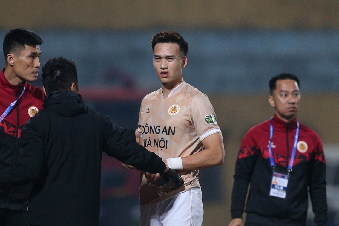 doi tuyen viet nam mat quan truoc tran gap indonesia o vong loai world cup hinh 1