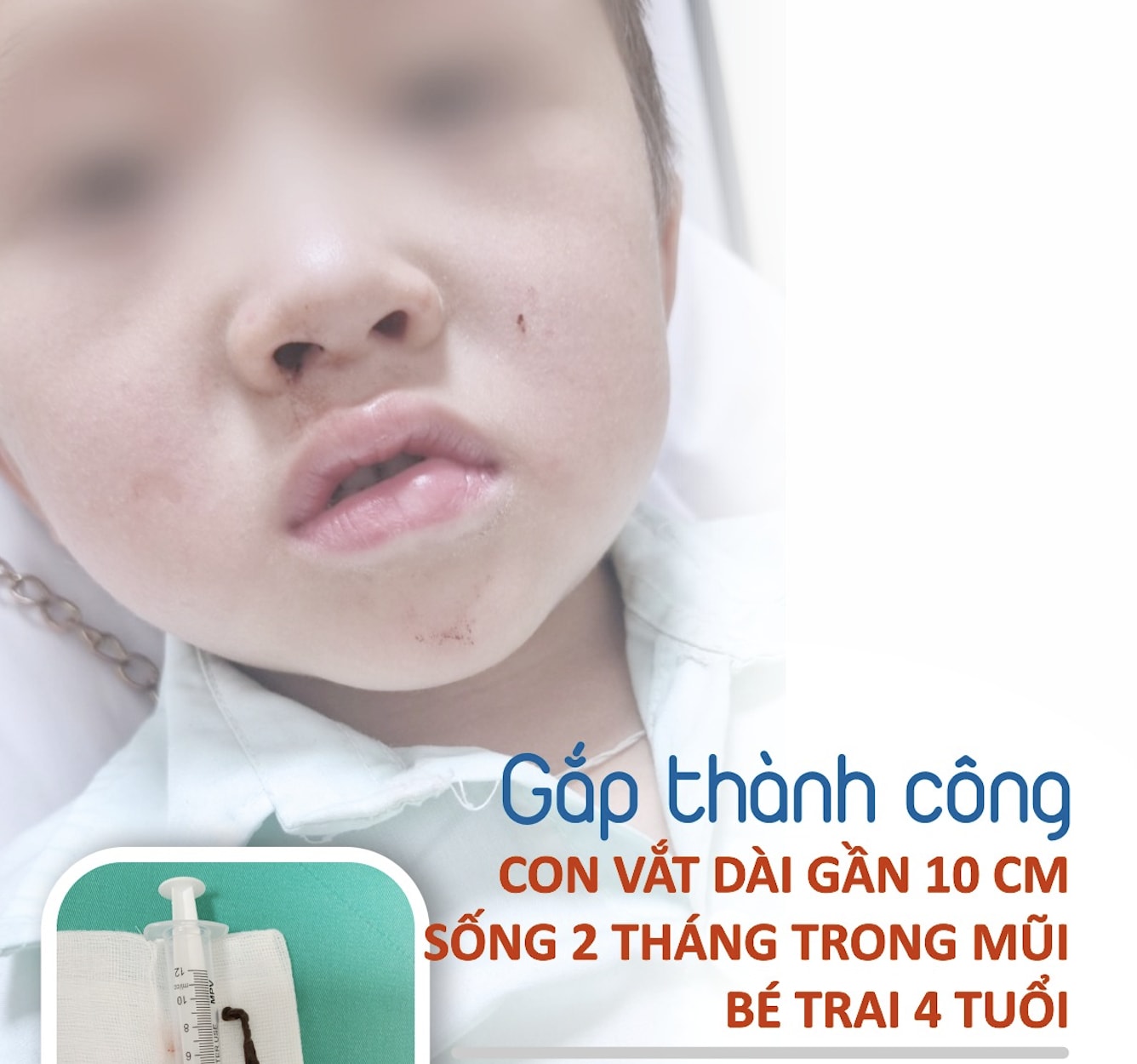 lao cai kip thoi gap con vat suoi dai 10 cm song 2 thang trong mui be trai 4 tuoi hinh 1