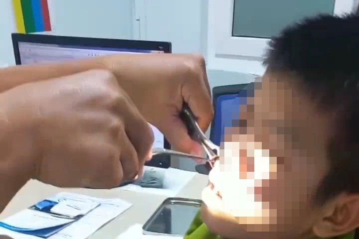 kon tum gap con vat dai 8cm song trong mui thieu nien 15 tuoi hinh 1