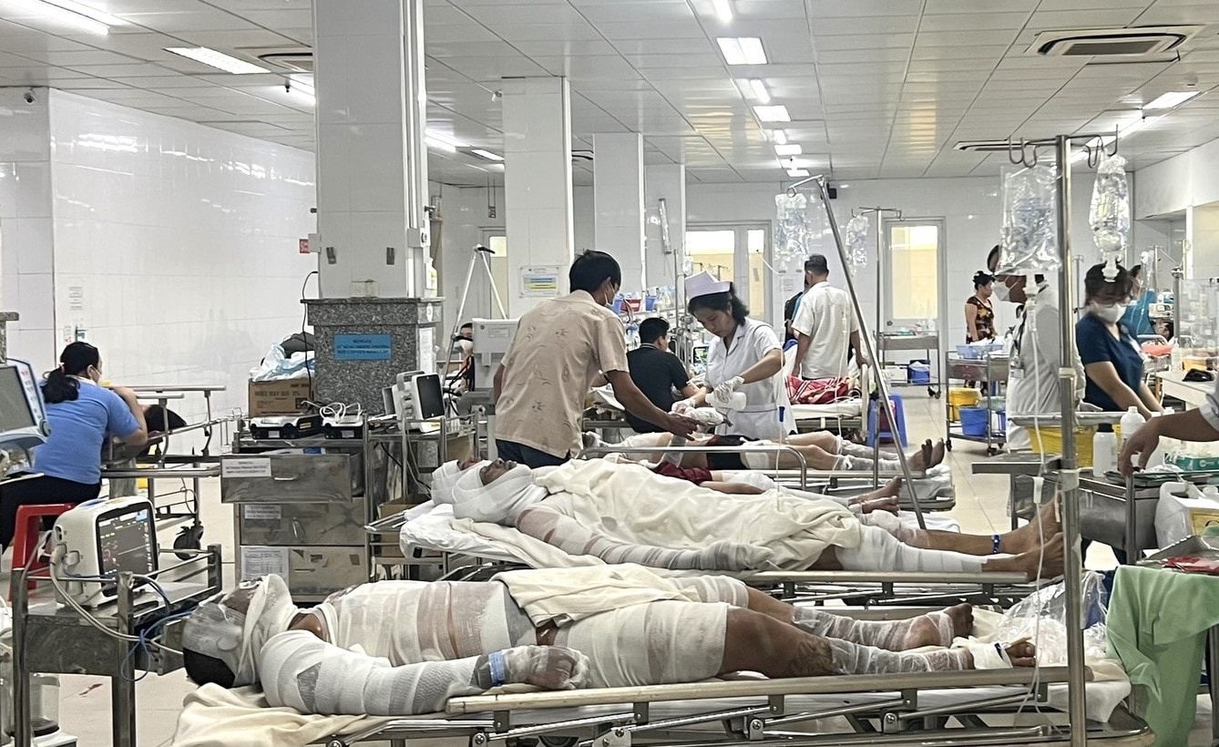 no bon chua bui 9 cong nhan bi bong nang hinh 1