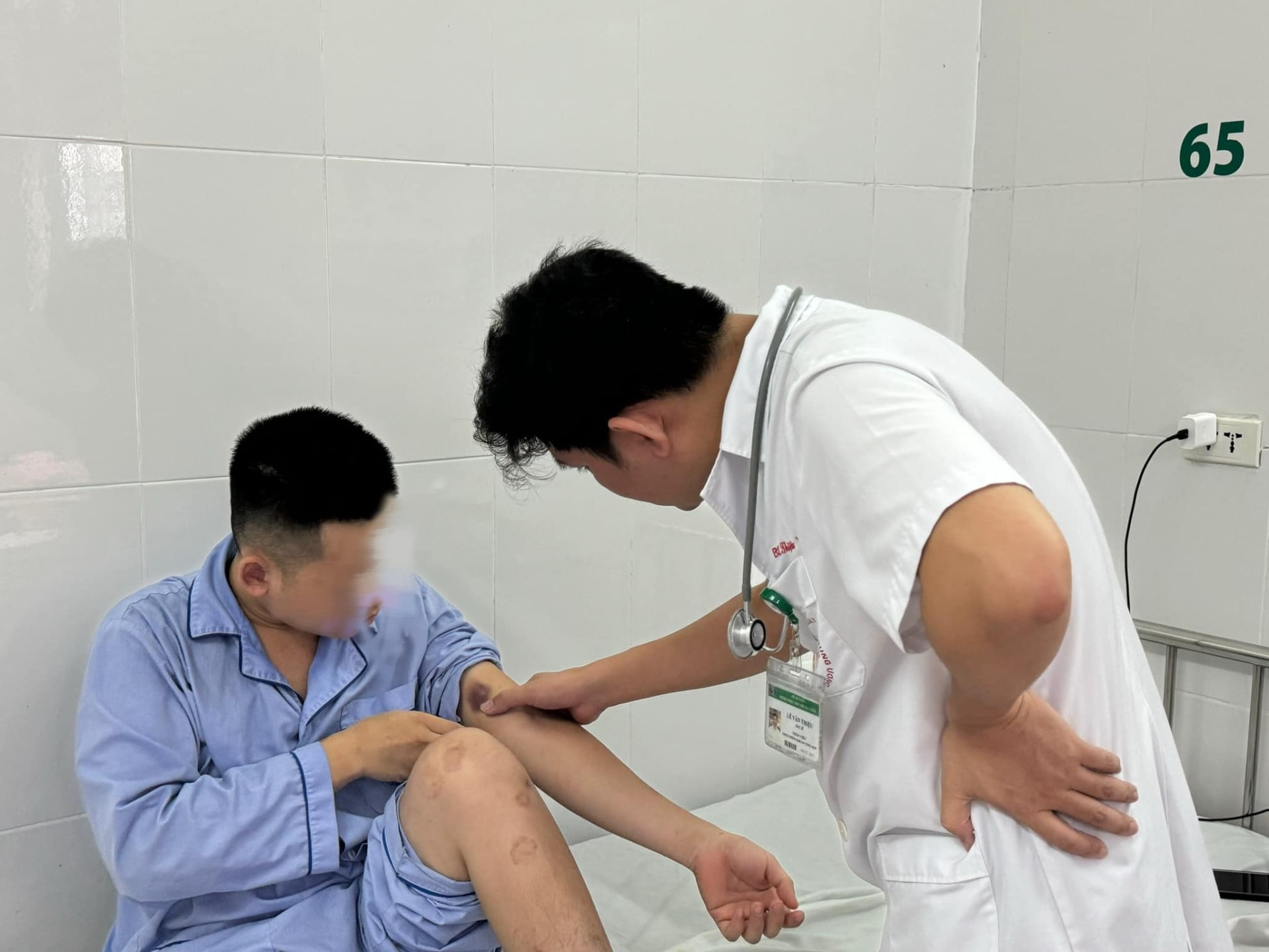 bi ngua toan than di kham moi biet mac ky sinh trung la hinh 1