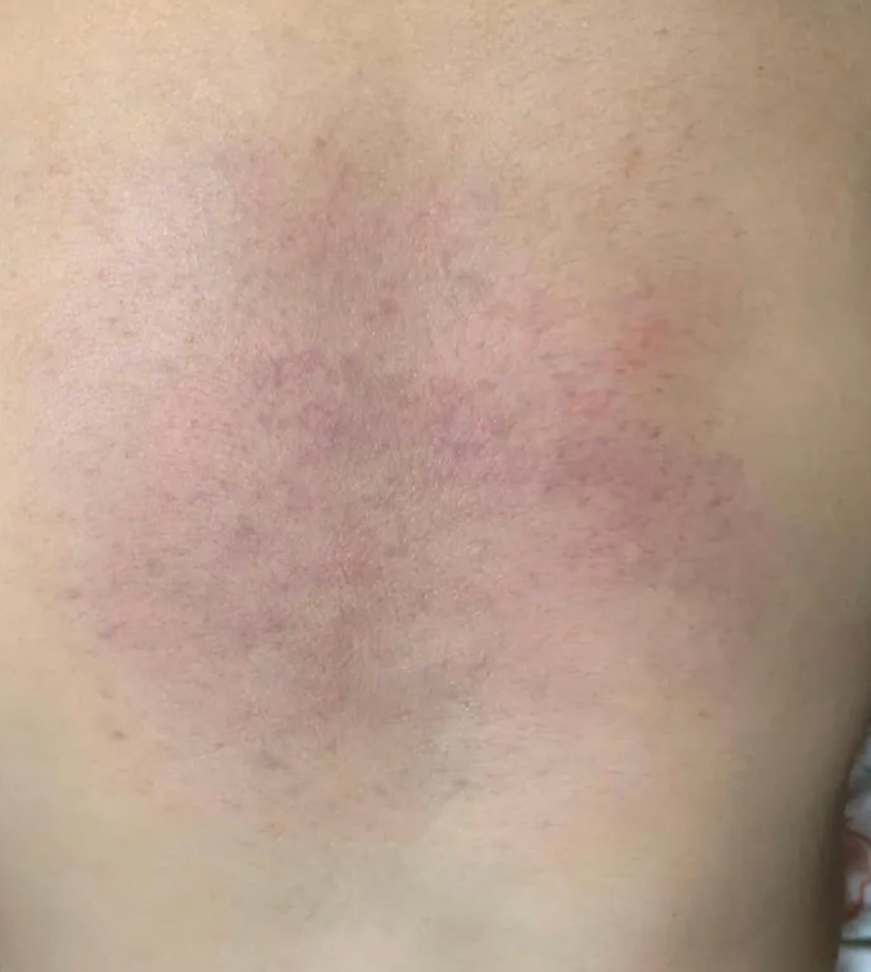 xac minh vu chau be nghi bi bao hanh o nhom giu tre tai binh thuan hinh 1