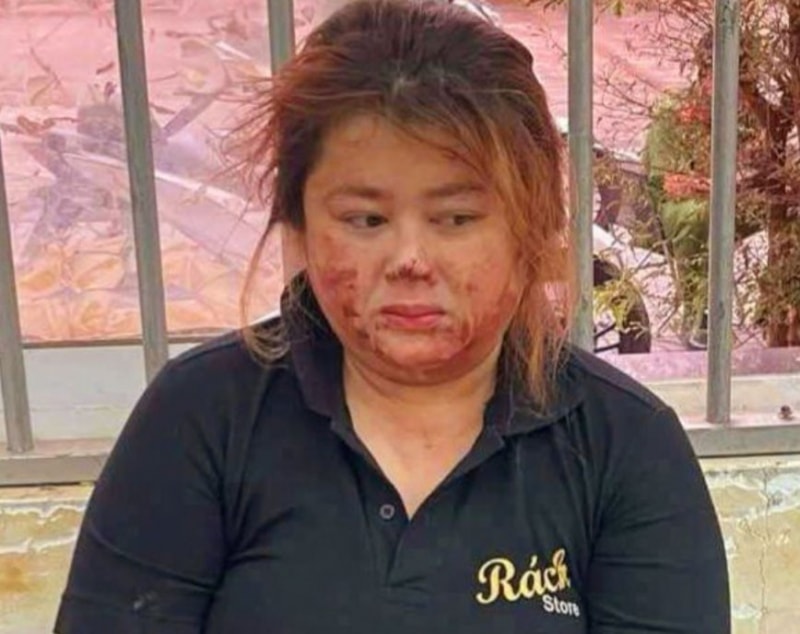 bat doi tuong dung dao dam chong ho tu vong hinh 1