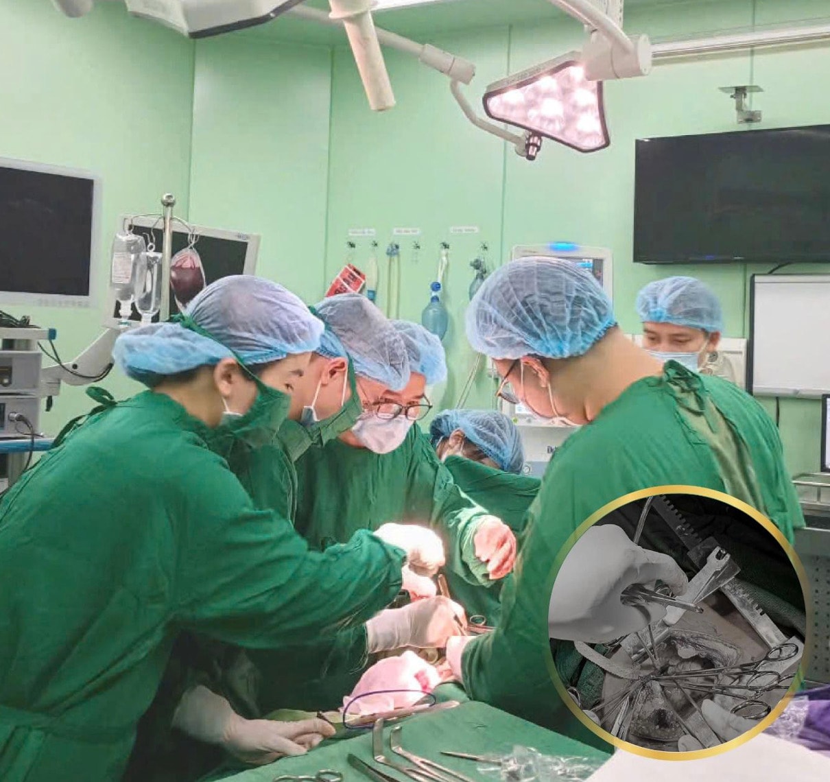cuu song benh nhan ngung tim ngoai vien do vet thuong thau nguc hinh 2