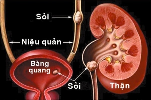 soi_1.jpg