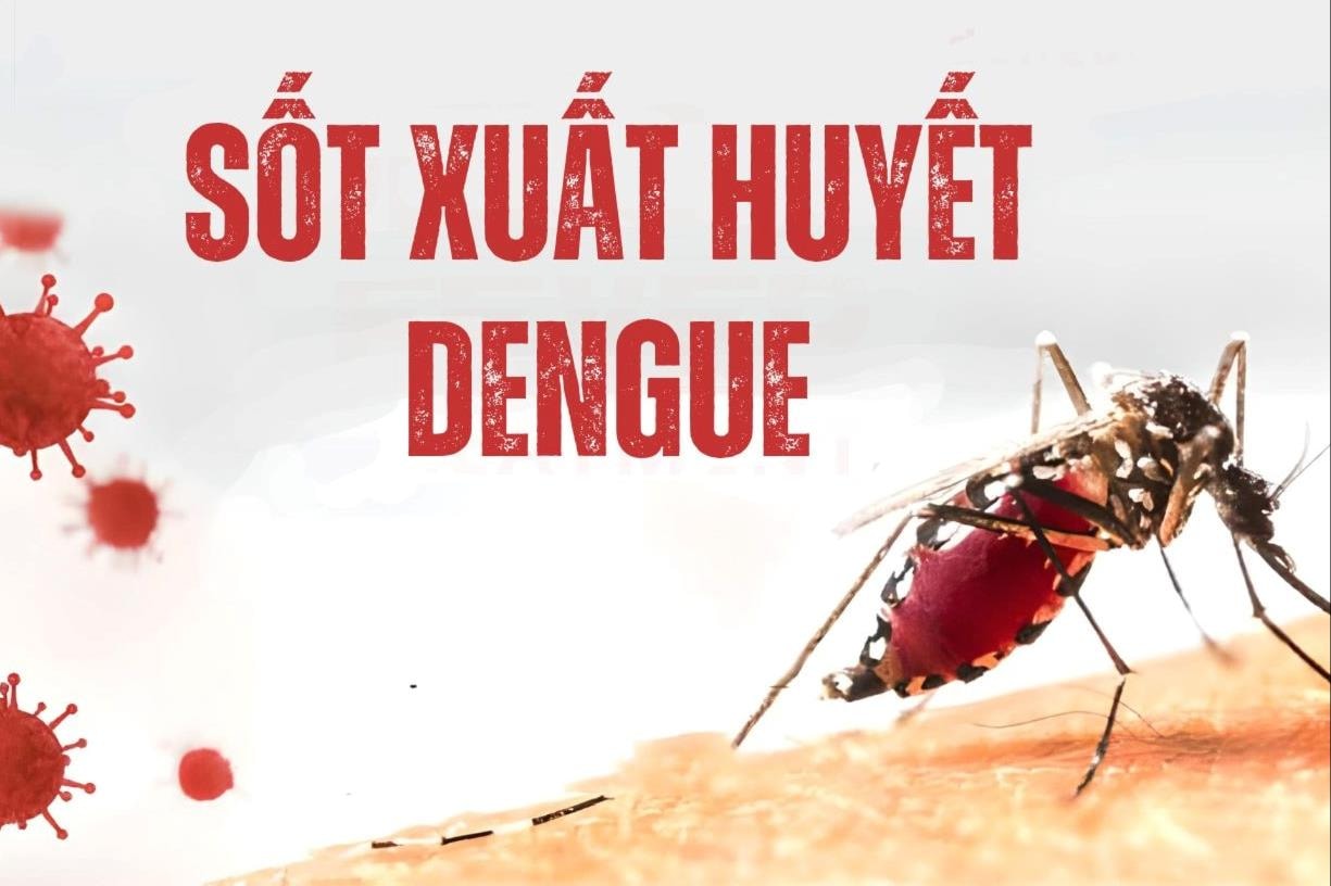 sot-xuat-huyet(1).jpg