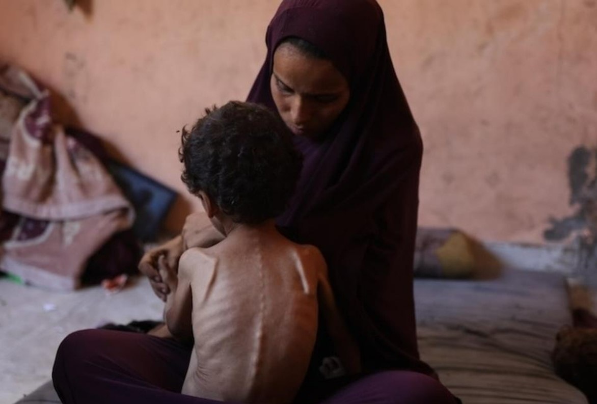 Một câu bé 2 tuổi tại trại tị nạn Shati ở Gaza. (Ảnh: UNICEF)