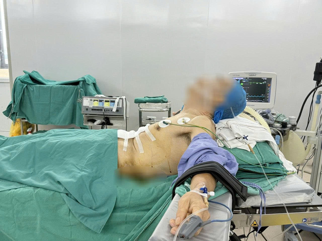 Bệnh nhân 'nửa nằm, nửa ngồi' trong ca phẫu thuật ung thư dạ dày- Ảnh 2.