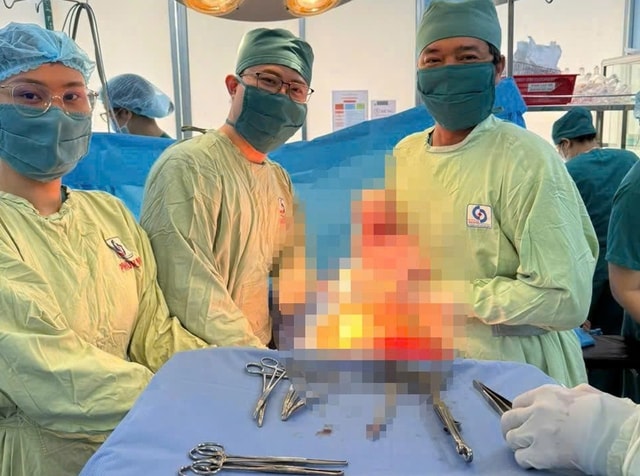 Thai phụ mắc bệnh cực hiếm Budd-Chiari vượt cạn an toàn- Ảnh 2.