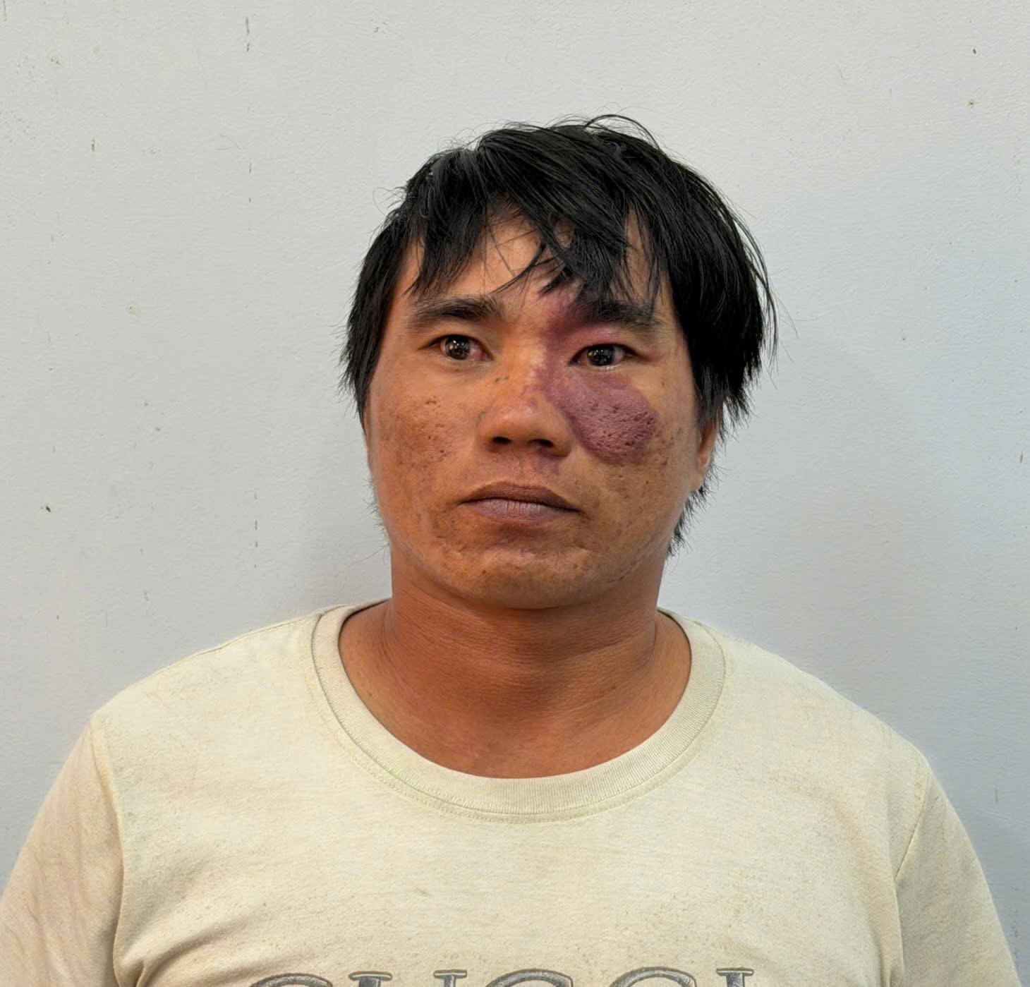 Nam thanh niên vay tiền không trả, đánh chủ nợ tử vong