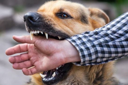 Gia Lai: Không tiêm vắc xin, người phụ nữ tử vong sau 1 tháng bị chó cắn