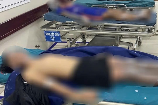 Quảng Bình: 4 thiếu niên bỏng nặng vì chế tạo pháo theo hướng dẫn trên mạng