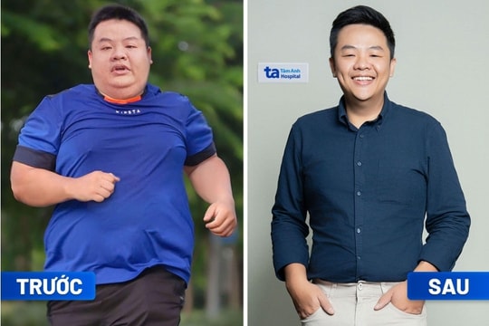 Thoát “bụng bia” nhờ giảm cân chuẩn y khoa