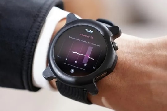 OnePlus Watch 3 có thể tích hợp tính năng theo dõi huyết áp như Galaxy Watch
