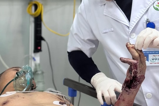 Nổ bình ga mini, một người phải cắt cụt chân