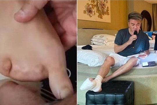 Thông tin ca sĩ Đàm Vĩnh Hưng bị mất 4 ngón chân là sai sự thật