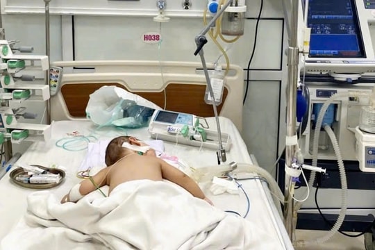 Suy hô hấp cấp tiến triển (ARDS) do Cúm A: Bé trai 7 tháng tuổi được cứu sống ngoạn mục