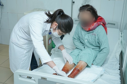 Ngâm chân bằng bột lá không rõ nguồn gốc, một phụ nữ suýt hoại tử hai chân