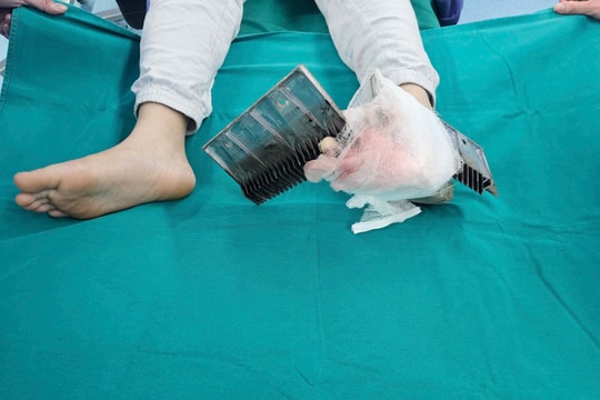 Bị thang cuốn kẹp vào chân, bé trai Hà Nội phải mổ cấp cứu