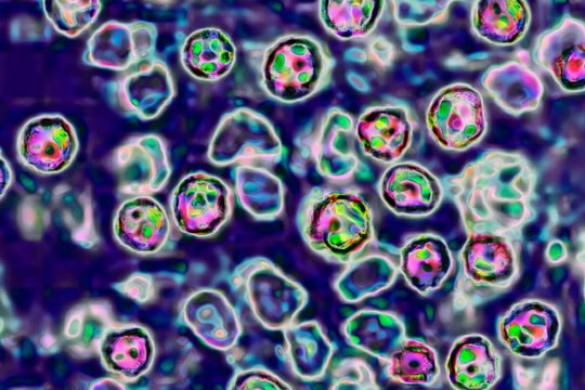 Châu Âu có số ca mắc bệnh sởi cao nhất trong 25 năm qua