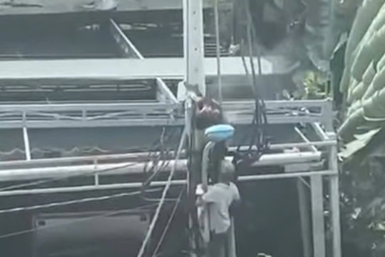 Cột điện phát nổ, người đàn ông bị bỏng nặng toàn thân phải nhập viện