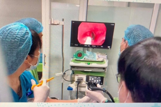 Lào Cai: Nội soi đưa con đỉa dài gần 8 cm ra khỏi khí quản bệnh nhân
