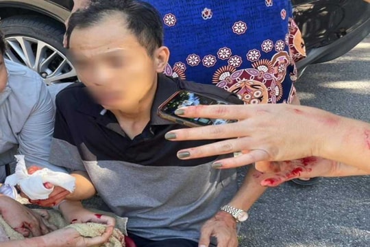 Chủ tịch công ty thuê giang hồ chém cổ đông để thâu tóm doanh nghiệp