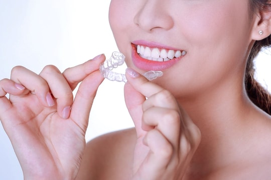 Trải nghiệm niềng răng Invisalign tại Nha Khoa Đăng Lưu