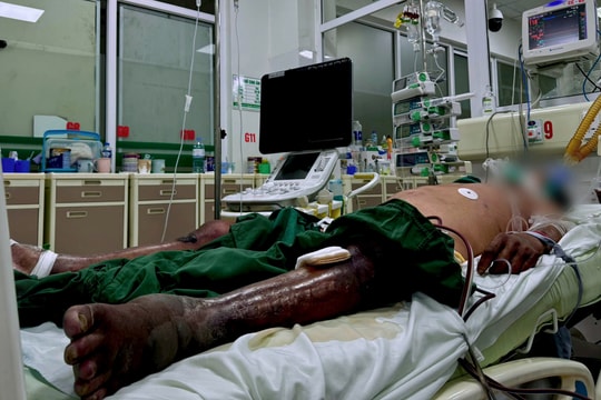 Bị gai đâm ở đầm tôm, hai chân hoại tử có nguy cơ lan ra toàn thân