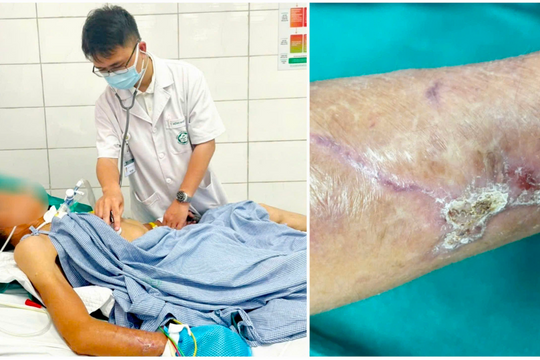 Nhiều bệnh nhân suýt mất mạng vì bị nhiễm trùng uốn ván