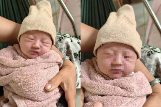 Gia Lai: Phát hiện một bé gái sơ sinh nặng gần 4kg được bọc trong túi nilon