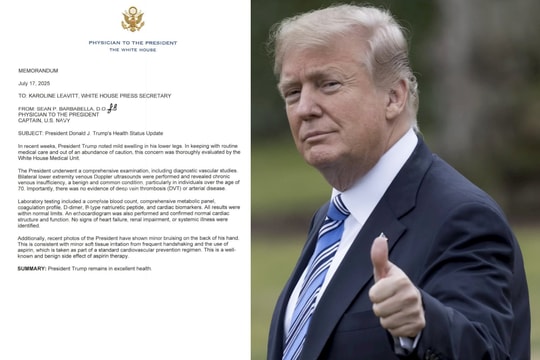 Ông Trump chỉ mắc bệnh tĩnh mạch gây sưng chân, sức khỏe hoàn toàn bình thường