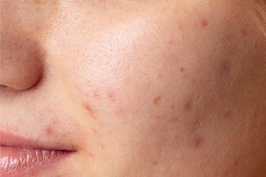 Thu hồi, tiêu hủy hàng loạt mỹ phẩm Image Skincare vì vi phạm nghiêm trọng nhãn mác, công thức